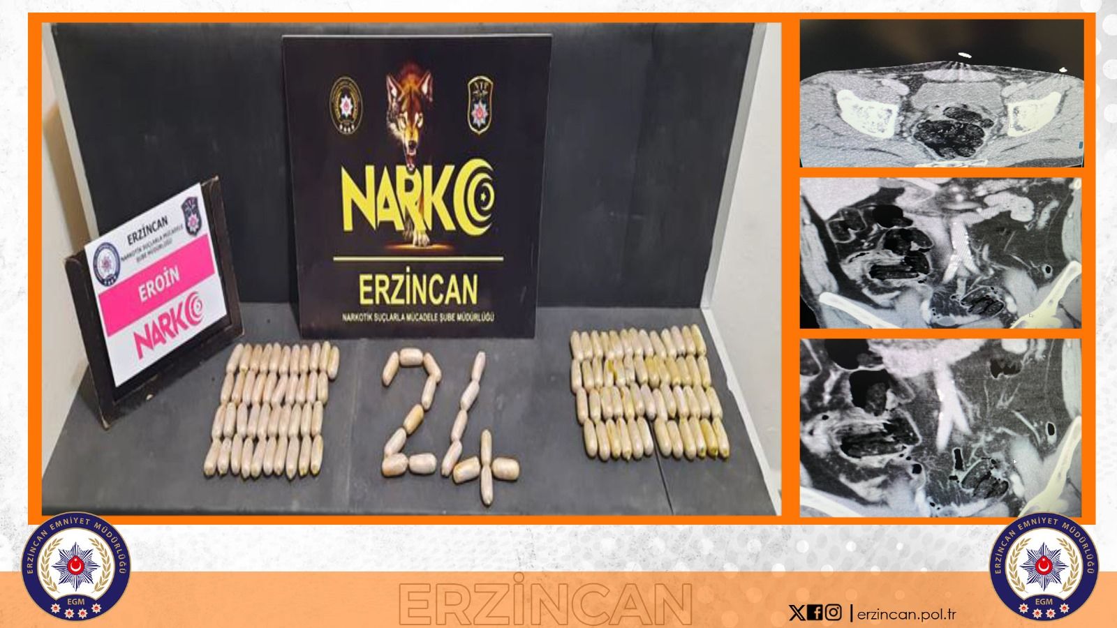 2 yolcunun midesinden toplam 780,69 dram eroin maddesi çıktı