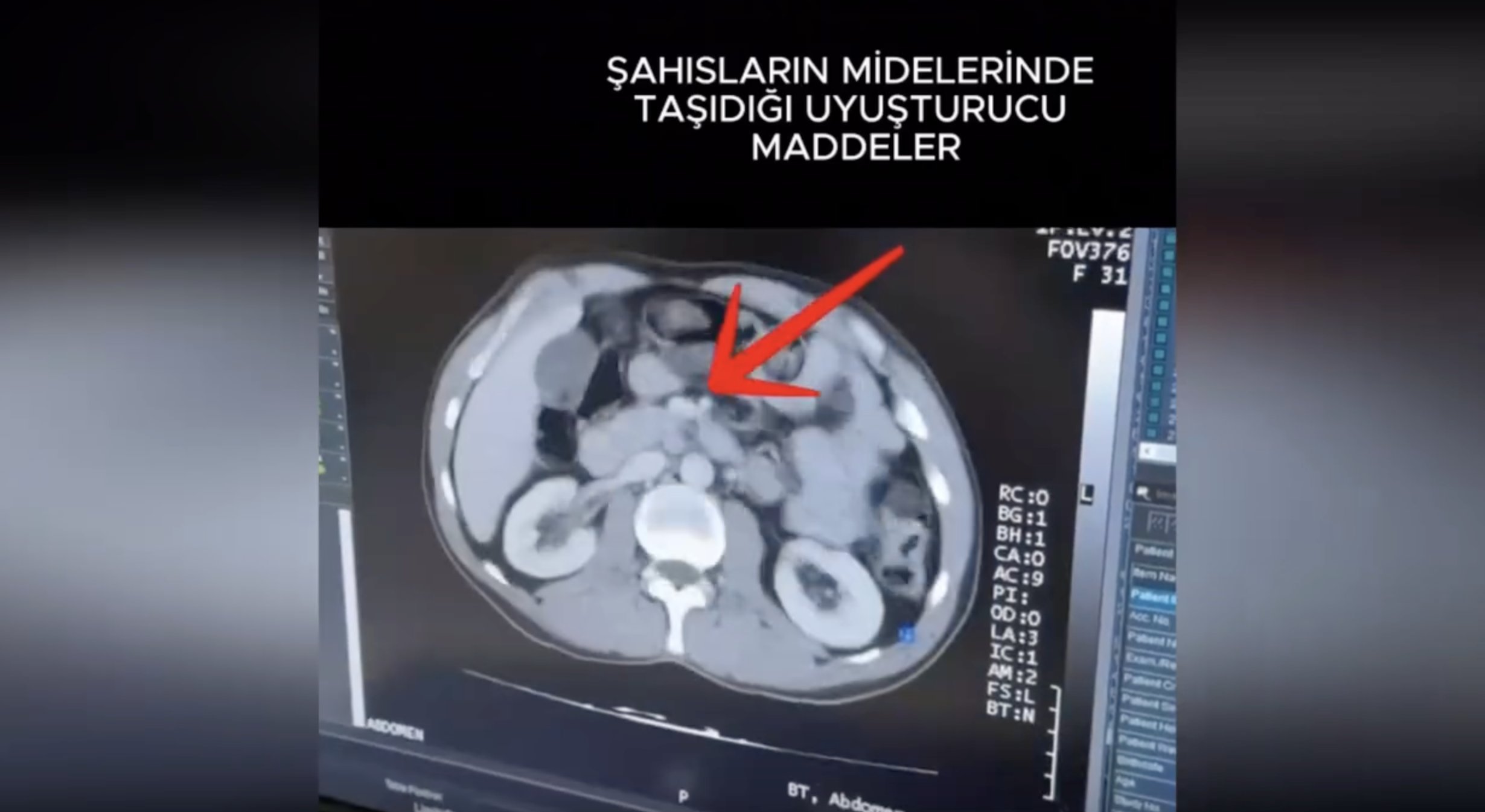 YUTTUKLARI 1 KİLO METAMFETAMİNLE YAKALANDILAR!